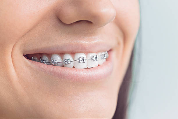 Best Veneers and Lumineers  in Dora, AL